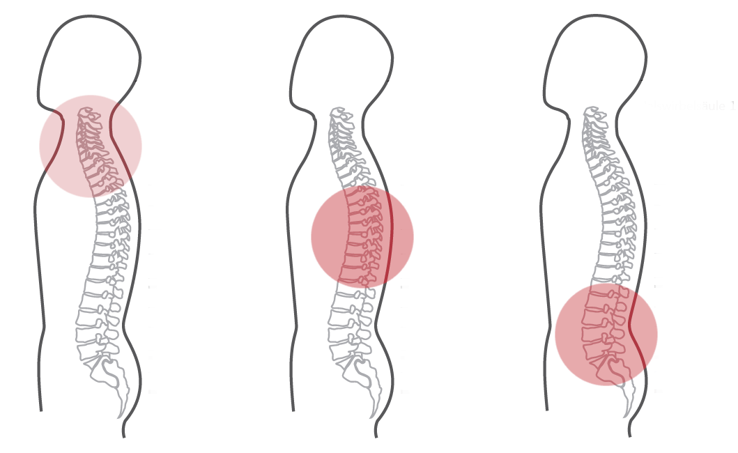Grafik zum CERAGEM Programm Nummer 2 der Master V4 Liege. Die Intensität der roten Farbkreise stellt den Fokus der Massage dar. Halswirbelsäule: Schwach. Brustwirbelsäule: Stark. Unterer Rücken: Mittel.