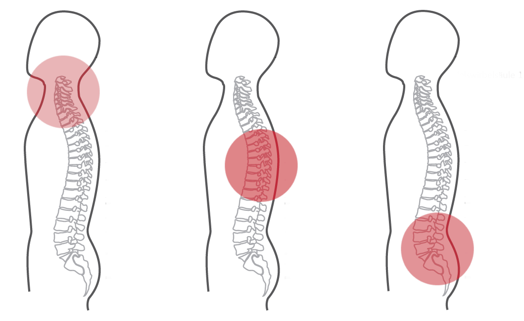 Grafik zum CERAGEM Standarprogramm der Master V3 Liege. Die Intensität der roten Farbkreise stellt den Fokus der Massage dar. Halswirbelsäule: schwach. Brustwirbelsäule: mittel. Unterer Rücken stark.