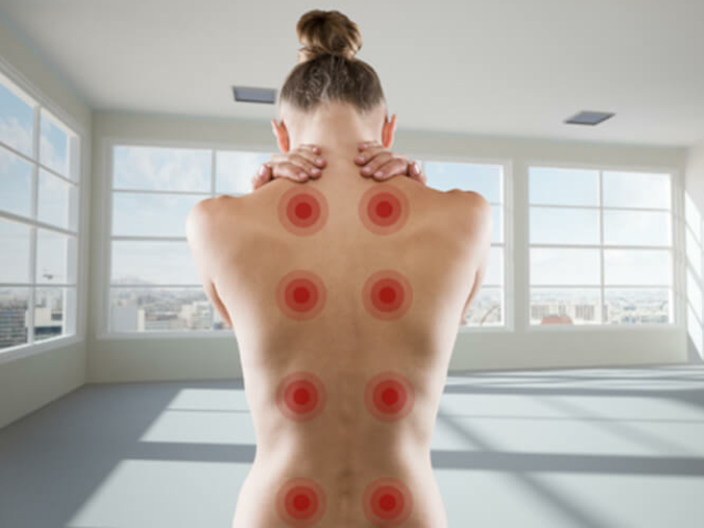 Ein Junge blonde Frau mit dem Rücken zum Betrachter hält sich mit beiden Händen den Nacken. Auf der rechten und auf der linken Seite sind über die ganze Länge des Rückens je vier rote Punkte zu sehen. Diese stellen die Akupressuranwendung dar.