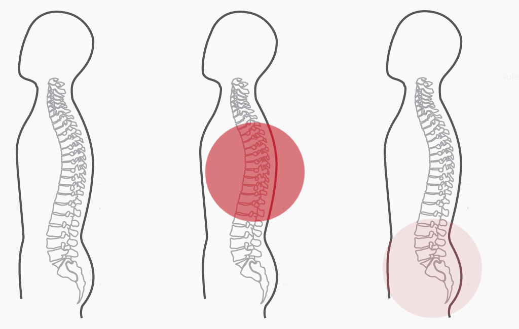 Grafik für das zweite empfohlene CERAGEM Programm der Master V4 Liege, bei Schmerzen im oberen Rücken. Die Silhouette eines Mannes ist zu sehen. Die Intensität der roten Farbkreise stellt den Fokus der Massage dar. Brustwirbelsäule: Stark. Unterer Rücken: Schwach.
