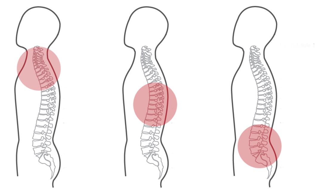 Grafik für das erste empfohlene CERAGEM Programm der Master V4 Liege, bei Schmerzen im unteren Rücken. Die Silhouette eines Mannes ist zu sehen. Die Intensität der roten Farbkreise stellt den Fokus der Massage dar. Halswirbelsäule: Stark. Brustwirbelsäule: Stark. Unterer Rücken: Stark.