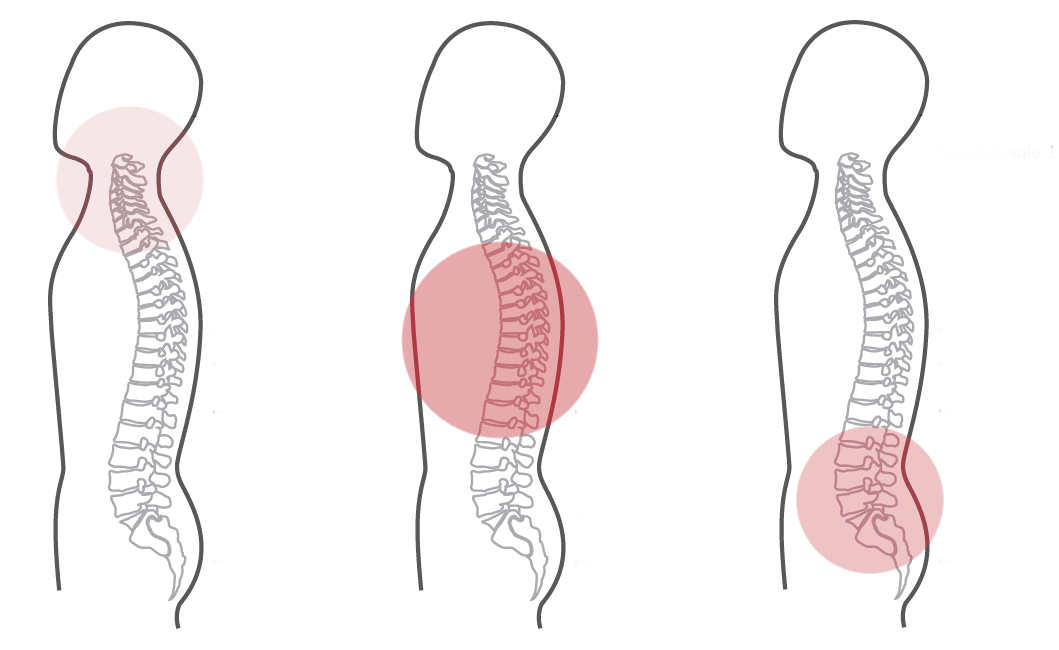 Grafik zum Programm Nummer 8 der CERAGEM Master V4 Liege. Die Intensität der roten Farbkreise stellt den Fokus der Massage dar. Halswirbelsäule: Schwach. Brustwirbelsäule: Stark. Unterer Rücken: Mittel.