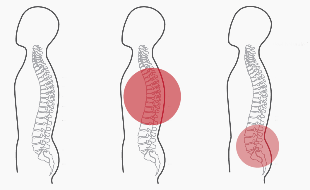 Grafik zum Programm Nummer 9 der CERAGEM Master V4 Liege. Die Intensität der roten Farbkreise stellt den Fokus der Massage dar. Brustwirbelsäule: Stark. Unterer Rücken: Mittel.