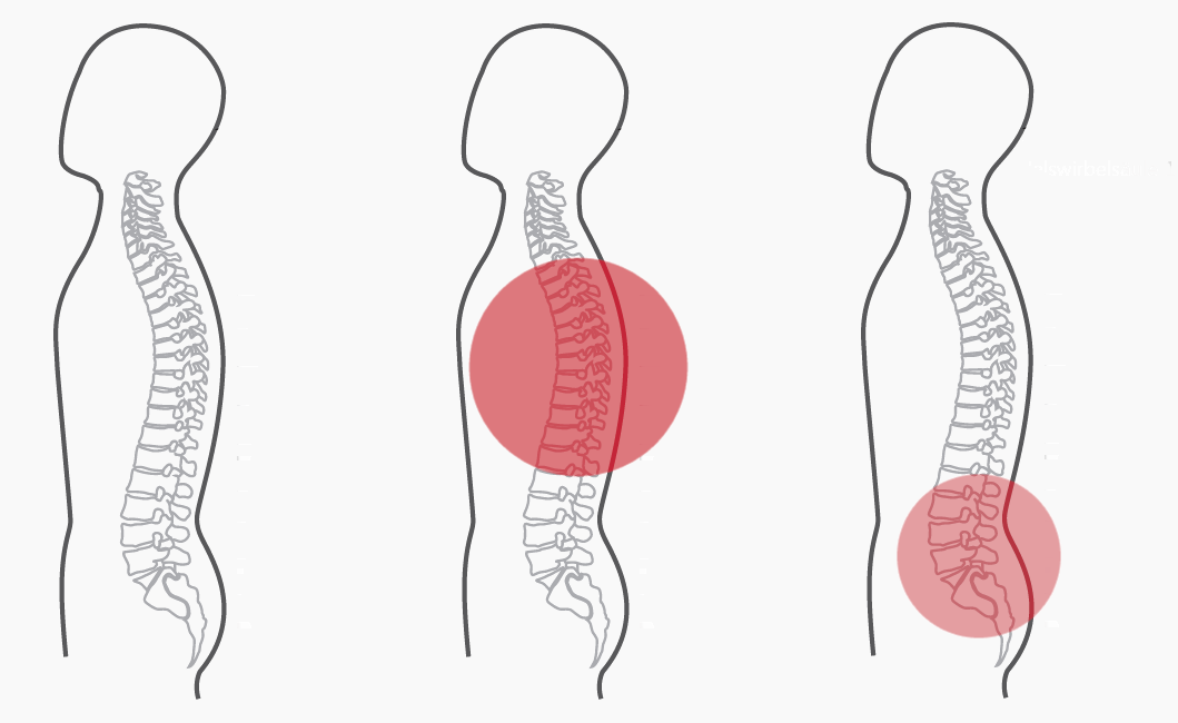 Grafik zum Programm Nummer 9 der CERAGEM Master V3 Liege. Die Intensität der roten Farbkreise stellt den Fokus der Massage dar. Brustwirbelsäule: Stark. Unterer Rücken: Mittel.
