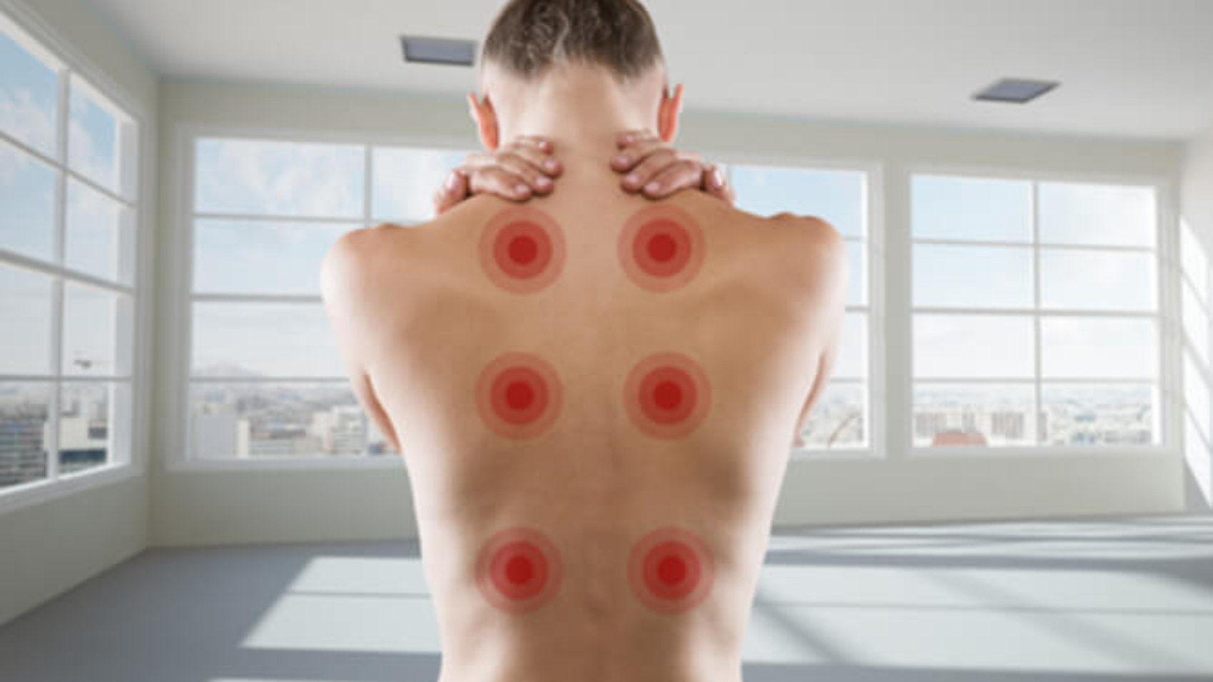 Ein Junge blonde Frau mit dem Rücken zum Betrachter hält sich mit beiden Händen den Nacken. Auf der rechten und auf der linken Seite sind über die ganze Länge des Rückens je vier rote Punkte zu sehen. Diese stellen die Akupressuranwendung dar.