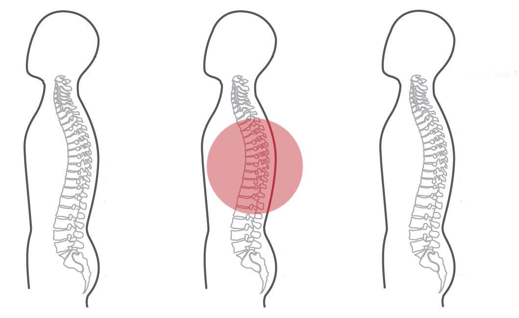 Grafik zum Programm Nummer 4 der CERAGEM Master V4 Liege. Die Intensität der roten Farbkreise stellt den Fokus der Massage dar. Brustwirbelsäule: Stark.