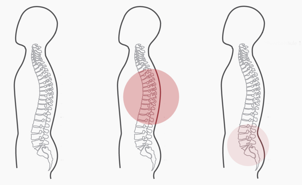 Grafik zum Programm Nummer 3 der CERAGEM Master V4 Liege. Die Intensität der roten Farbkreise stellt den Fokus der Massage dar. Brustwirbelsäule: Mittel. Unterer Rücken: Schwach.