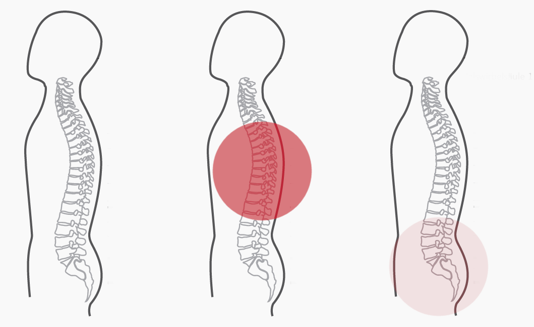 Grafik zum Programm Nummer 5 der CERAGEM Master V4 Liege. Die Intensität der roten Farbkreise stellt den Fokus der Massage dar. Brustwirbelsäule: Stark. Unterer Rücken: Schwach.