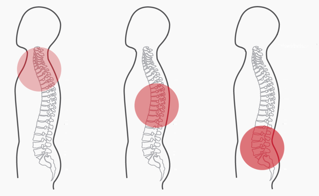 Grafik zum Basisprogramm (Programm 1) der CERAGEM Master V3 Liege. Die Intensität der roten Farbkreise stellt den Fokus der Massage dar. Halswirbelsäule: Leicht. Brustwirbelsäule: Mittel. Unterer Rücken: Stark.
