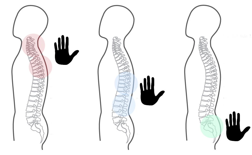 Grafik für das zweite empfohlene CERAGEM Programm der Master V4 Liege, bei Schmerzen im ganzen Rücken. Die Silhouette eines Mannes ist zu sehen. Die farbigen Kreise zeigen an, dass der ganze Rücken massiert werden kann. Das Handsymbol zeigt an, dass das Programm von Hand eingestellt werden muss.