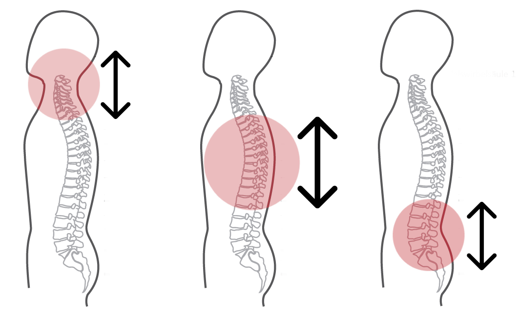 Grafik zum Intensivprogramm der CERAGEM Master V4 Liege. Die Auf- und Abpfeile zeigen an, dass sich die Massage intensiv nach oben und unten erstreckt.