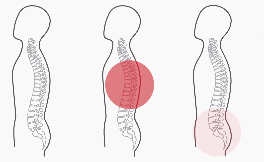 Grafik zum Programm Nummer 5 der CERAGEM Master V3 Liege. Die Intensität der roten Farbkreise stellt den Fokus der Massage dar. Brustwirbelsäule: Stark. Unterer Rücken: Schwach.