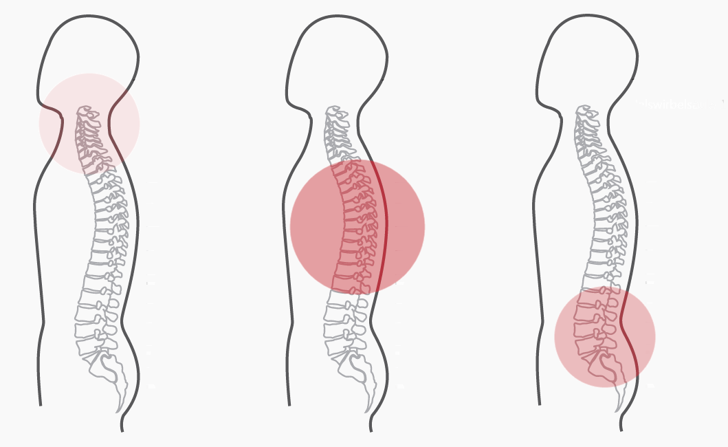 Grafik zum Programm Nummer 7 der CERAGEM Master V3 Liege. Die Intensität der roten Farbkreise stellt den Fokus der Massage dar. Brustwirbelsäule: Stark. Unterer Rücken: Mittel.