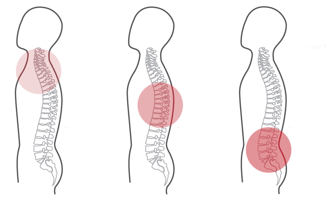 Grafik für das erste empfohlene CERAGEM Programm der Master V3 Liege, bei Schmerzen im unteren Rücken. Die Silhouette eines Mannes ist zu sehen. Die Intensität der roten Farbkreise stellt den Fokus der Massage dar. Halswirbelsäule: Leicht. Brustwirbelsäule: Mittel. Unterer Rücken: Stark.